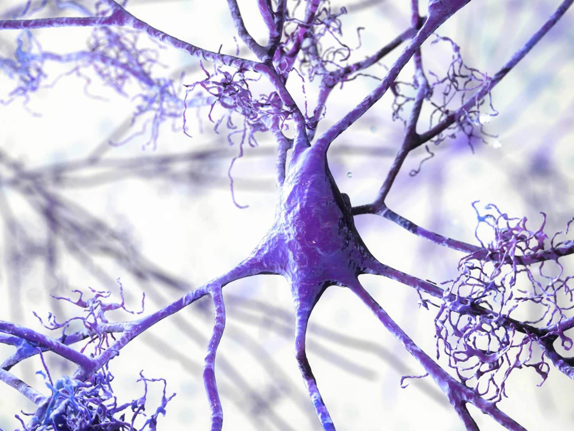 Alzheimer, l’idea: combattiamolo ripristinando il dialogo interrotto tra i neuroni