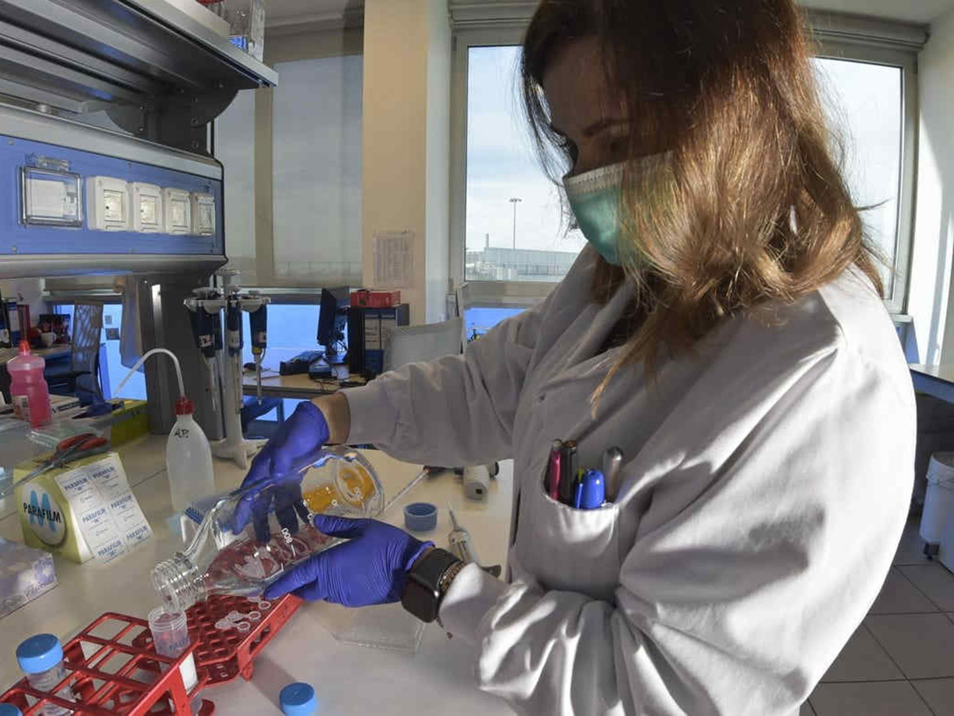 Alzheimer: gruppo di ricercatori italiani scopre un nuovo gene alla base della malattia