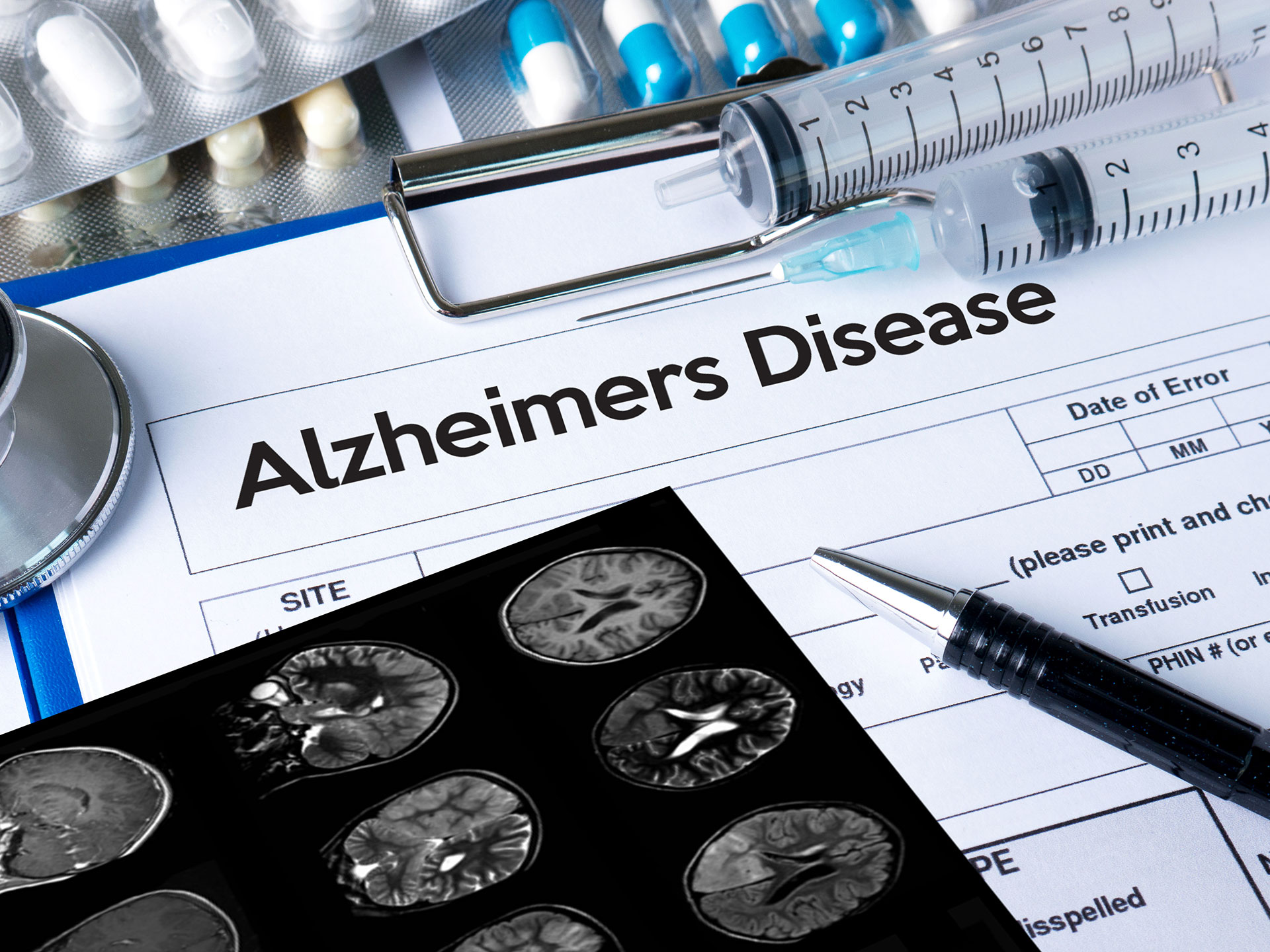 Alzheimer, la frequenza della respirazione a riposo più alta in chi ha la malattia