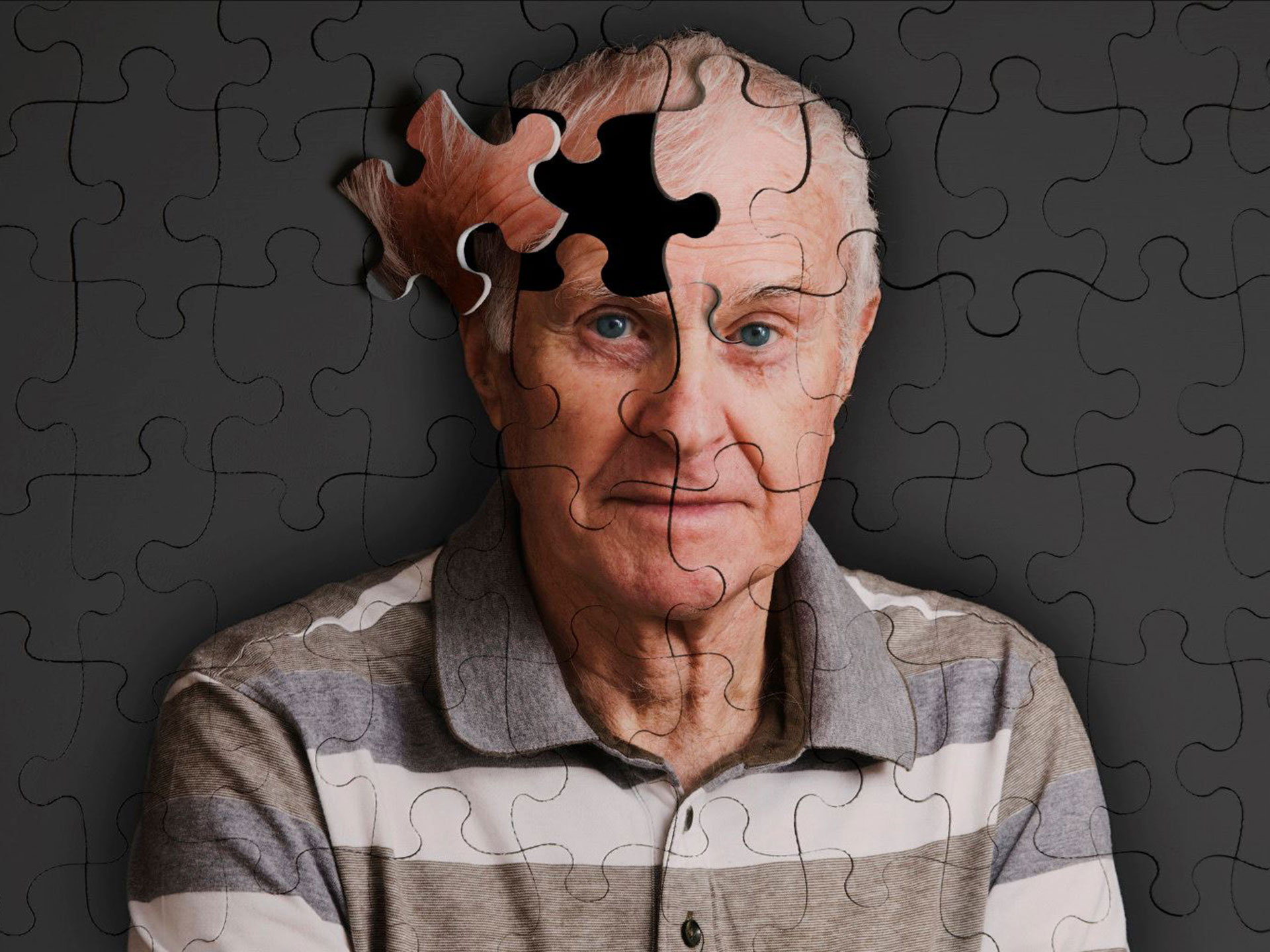 Alzheimer, ecco la scheda per calcolare il rischio di sviluppare la malattia nel giro di tre anni