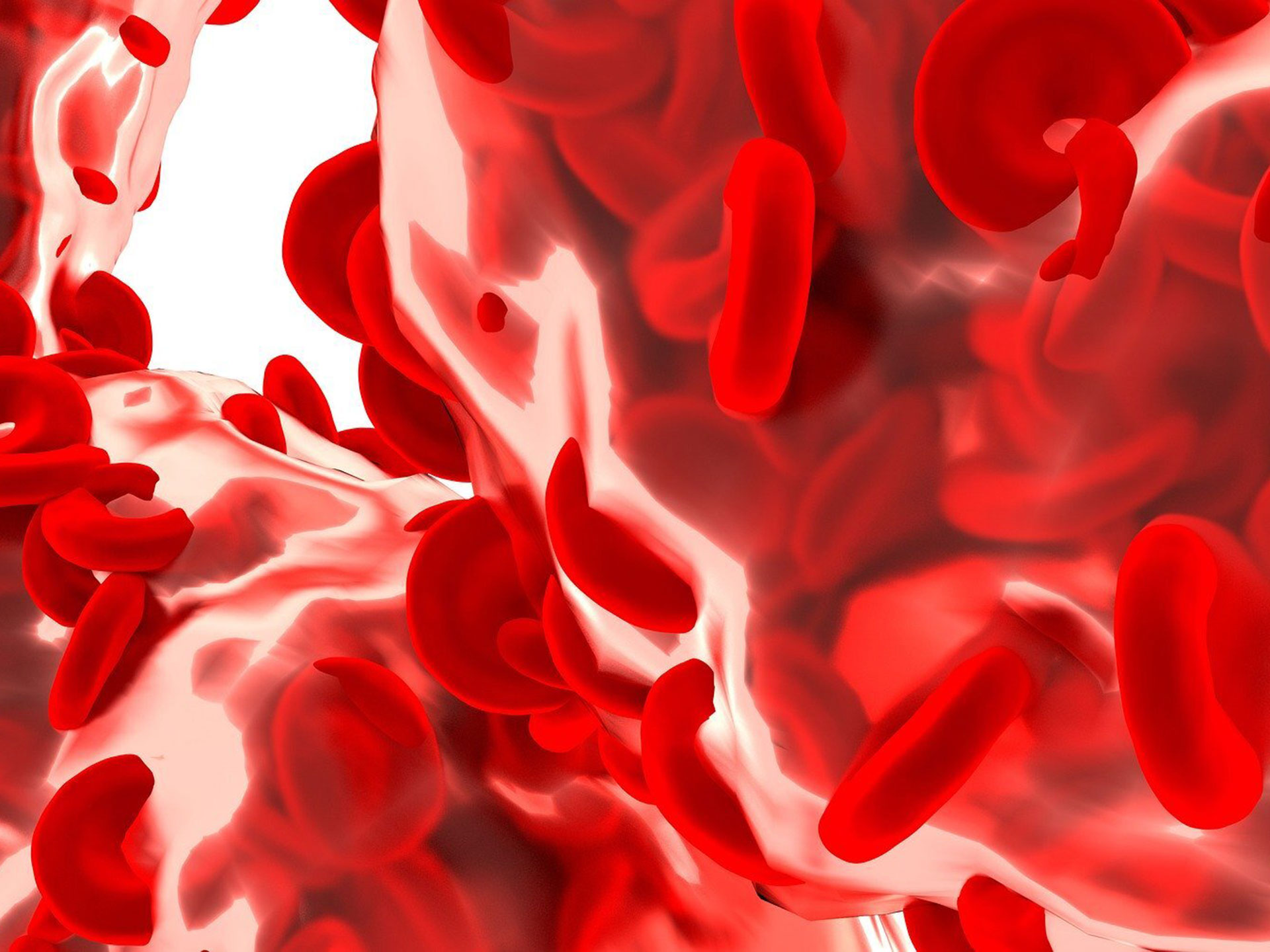 La gravità dell’Alzheimer stimata da un semplice test del sangue